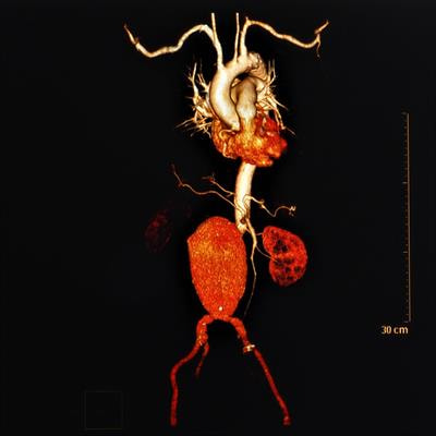 Cover image for research topic "Revolutions in Human Biospecimen Study: Leveraging new technologies to explore the pathology, therapeutics and biomarkers for atherosclerotic disease"