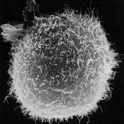 Cover image for research topic "Current Challenges in Complement Diagnostics"