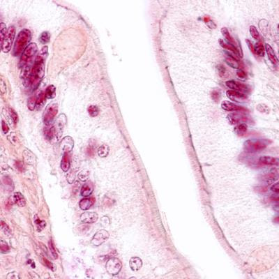 Cover image for research topic "Natural Product Treatment of Gastrointestinal Diseases"