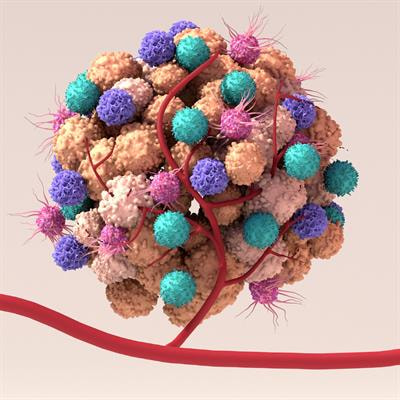 Cover image for research topic "Inflammatory Tumor Microenvironment: Role of Cytokines and Virokines in Breast Cancer Progression and Metastasis"