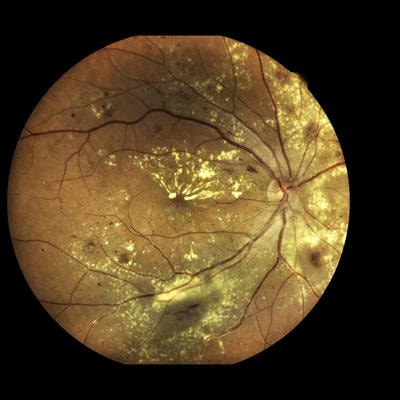 Cover image for research topic "Ocular Imaging Technology and Application"