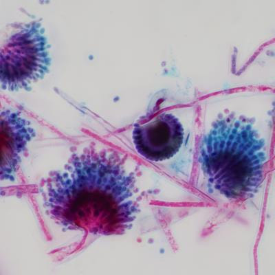 Cover image for research topic "Current Advances in the Metabolism of Mycotoxins in Plants"