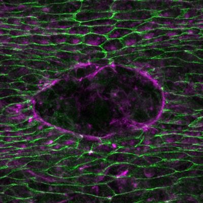 Cover image for research topic "Non-Cadherin Based Cell Adhesion in Tissue Remodeling"