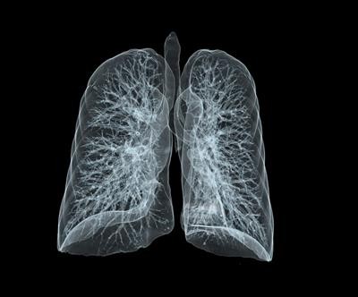 Cover image for "Recent Advances in Surgical Management of NSCLC"