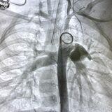 Cover image for "Case Reports in Structural Interventional Cardiology: 2023"